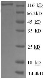 Recombinant Human Glycogen phosphorylase, brain form (PYGB), partial