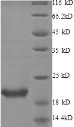 Recombinant Human Interleukin-1 receptor antagonist protein (IL1RN)