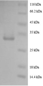 Recombinant Human Pro-epidermal growth factor (EGF) , partial