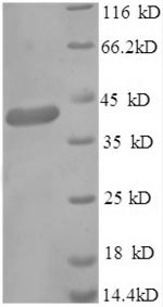 Recombinant Human Gamma-aminobutyric acid receptor-associated protein (GABARAP), partial