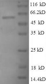 Recombinant Human Large ribosomal subunit protein uL3 (RPL3), partial