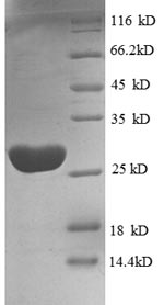 Recombinant Human Elongation factor Tu, mitochondrial (TUFM), partial