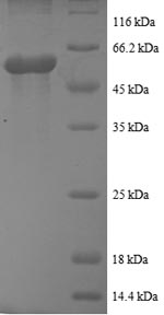 Recombinant Human Casein kinase I isoform epsilon (CSNK1E), partial