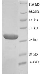 Recombinant Human Scaffold protein ILK (ILK), partial