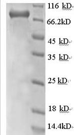 Recombinant Human Rab GDP dissociation inhibitor beta (GDI2), partial
