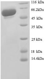 Recombinant Human Glyceraldehyde-3-phosphate dehydrogenase (GAPDH), partial