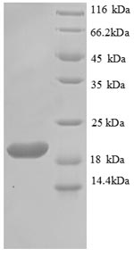 Recombinant Toxoplasma gondii Profilin (PRF)