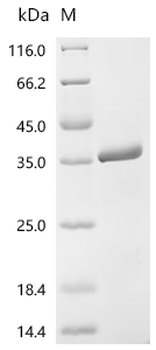 Recombinant Human Vesicle-associated membrane protein-associated protein A (VAPA), partial