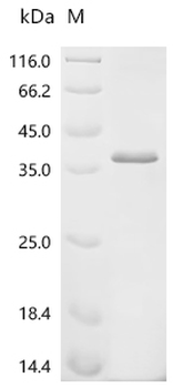 Recombinant Mouse H-2 class II histocompatibility antigen, A-B alpha chain (H2-Aa), partial