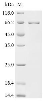 Recombinant Human Interleukin-19 (IL19), Biotinylated