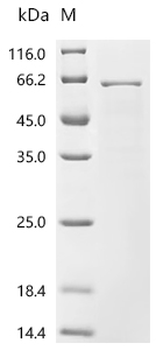 Recombinant Human Nucleoporin p54 (NUP54)
