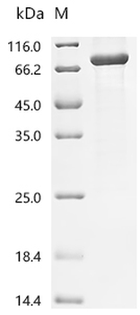 Recombinant Mycobacterium tuberculosis NAD(P)H dehydrogenase (quinone) (lpdA) (Δ284-301)