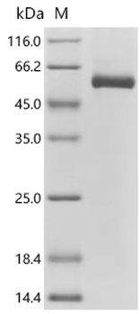 Recombinant Human Netrin-4 (NTN4), partial