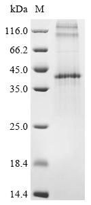 Recombinant Human Prostaglandin D2 receptor 2 (PTGDR2)