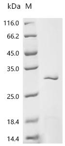 Recombinant Sulfolobus solfataricus Reverse gyrase 1 (rgy1), partial