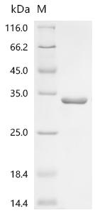 Recombinant Escherichia coli O157:H7 Transcriptional regulatory protein qseB (qseB)