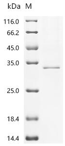 Recombinant Mouse 1-acyl-sn-glycerol-3-phosphate acyltransferase beta (Agpat2)-Detergent