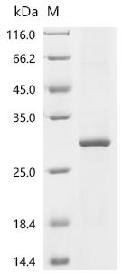 Recombinant Human Probable palmitoyltransferase ZDHHC24 (ZDHHC24)
