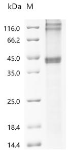 Recombinant Human Corticotropin-releasing factor receptor 2 (CRHR2)
