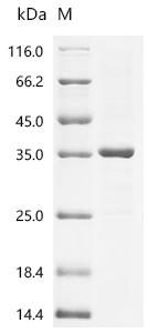 Recombinant Campylobacter jejuni subsp. jejuni serotype O:2 Cytolethal distending toxin subunit A (cdtA)