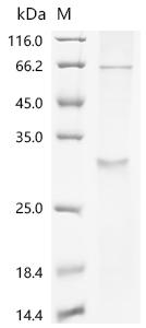 Recombinant Human Voltage-dependent calcium channel gamma-1 subunit (CACNG1)