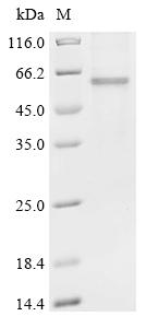Recombinant Human Actin, alpha skeletal muscle(ACTA1)