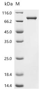 Recombinant Mouse Inhibin beta C chain (Inhbc)