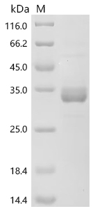 Recombinant Mouse Gastric inhibitory polypeptide (Gip), partial