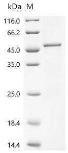 Recombinant Human Flavin-containing monooxygenase 3 (FMO3), partial