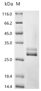 Recombinant Human Kallikrein-2 (KLK2)