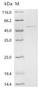Recombinant Human Glutamine synthetase (GLUL)