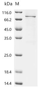 Recombinant Human Complement factor H (CFH), partial