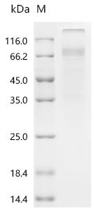 Recombinant Human Sodium/potassium-transporting ATPase subunit alpha-1 (ATP1A1), partial