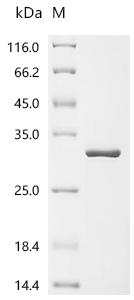 Recombinant Cowpea chlorotic mottle virus Capsid protein (ORF3b)