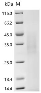 Recombinant Human Immunoglobulin J chain (JCHAIN)