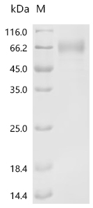 Recombinant Human Sodium-dependent phosphate transport protein 2B (SLC34A2),partial