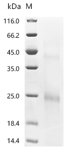 Recombinant Rat Ly6/PLAUR domain-containing protein 3 (Lypd3)