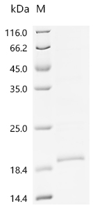 Recombinant Macaca fascicularis Macaca fascicularis brain cDNA clone: QorA-11660, similar to human lymphocyte antigen 6 complex, locus E (LY6E), mRNA, RefSeq: NM_002346.1
