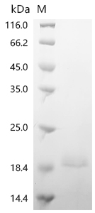 Recombinant Human GTPase KRas (KRAS) (G13D), partial