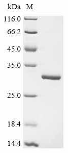Recombinant Human Peroxiredoxin-1 (PRDX1)