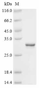 Recombinant Human Peroxiredoxin-1 (PRDX1)