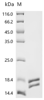 Recombinant Human Interleukin-2 (IL2) (Active)