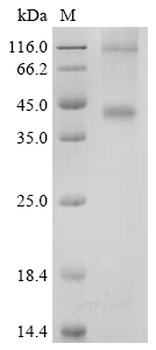 Recombinant Human G-protein coupled estrogen receptor 1(GPER)