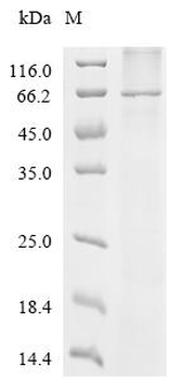 Recombinant Human Transmembrane protein 87A (TMEM87A)