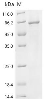 Recombinant Escherichia coli O6:H1 Sensor protein PhoQ (phoQ)