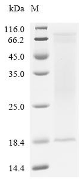 Recombinant Influenza A virus Matrix protein 2 (M)