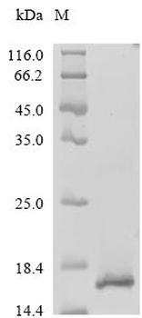 Recombinant Influenza A virus Matrix protein 2 (M)