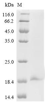Recombinant Influenza A virus Matrix protein 2 (M)