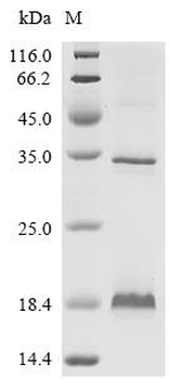 Recombinant Influenza A virus Matrix protein 2 (M)