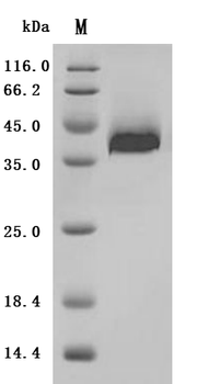 Recombinant Human Protein delta homolog 1 (DLK1), partial (Active)